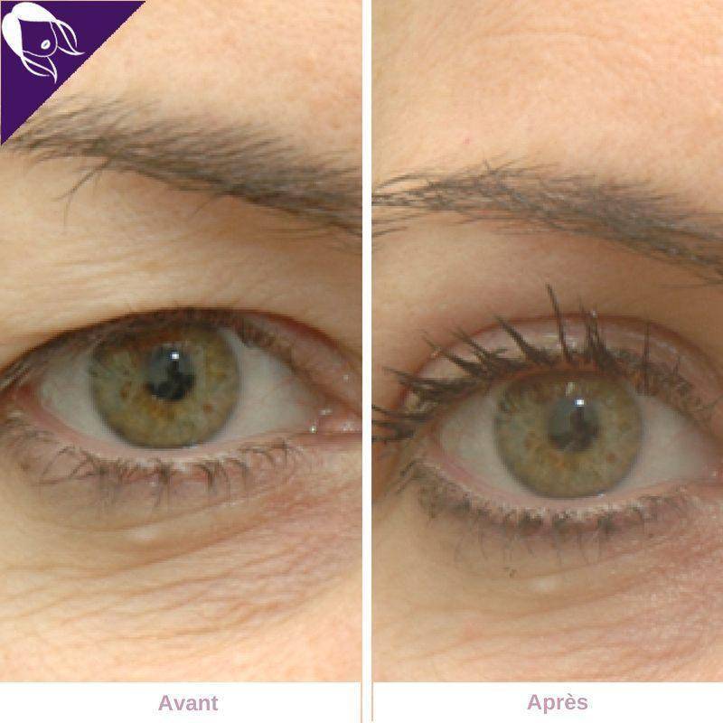 Dream Eyes™ - Réhausseurs de Paupières -50% AUJOURD'HUI !