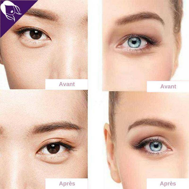 Dream Eyes™ - Réhausseurs de Paupières -50% AUJOURD'HUI !