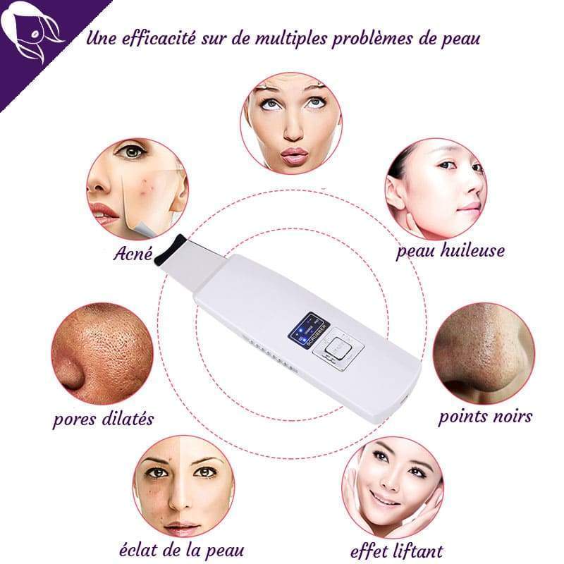 Peeling à Ultrasons pour le Visage