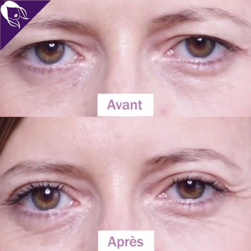Dream Eyes™ - Réhausseurs de Paupières -50% AUJOURD'HUI !