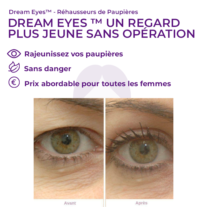 Dream Eyes™ - Réhausseurs de Paupières -50% AUJOURD'HUI !